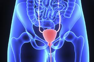 Medical depiction of ureter obstruction
