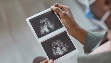 Expecting parent holding fetal ultrasound images