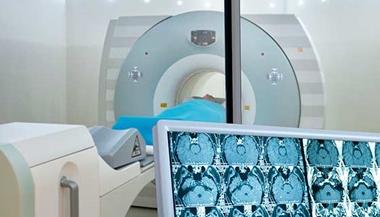 脑部扫描显示在电脑显示器上，背景是放射手术设备